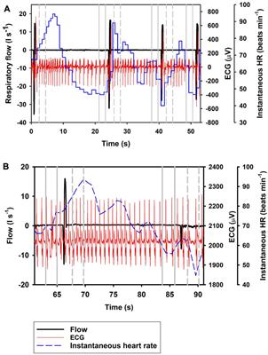 Cardiorespiratory coupling in the bottlenose dolphin (Tursiops truncatus)